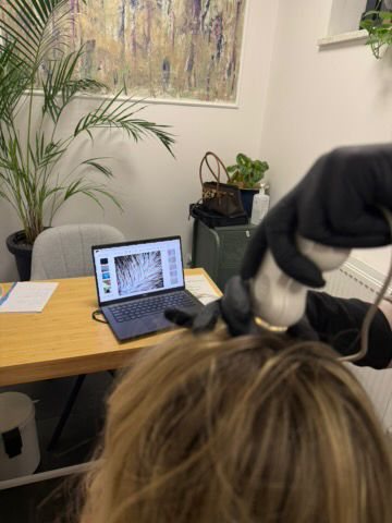 Trichoskopia skóry głowy pod powiększeniem, holi studio Bydgoszcz